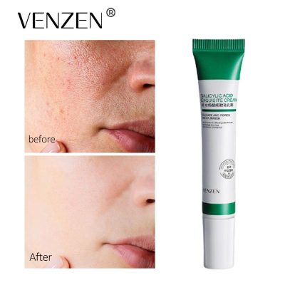 کرم سالیسیلیک اسید ضدجوش Veze